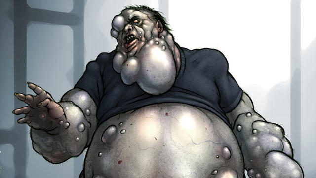 Hässliche Fratzen: Der Boomer aus Left 4 Dead
