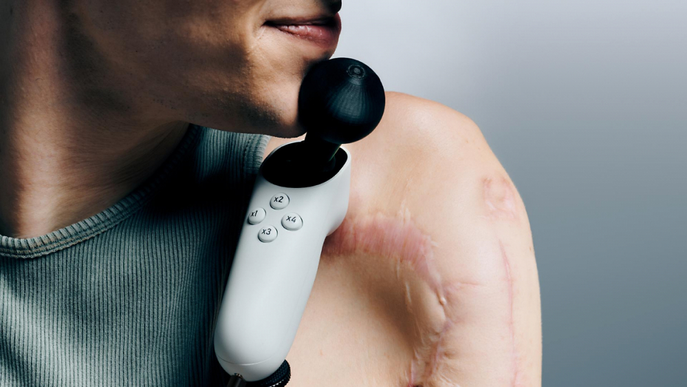 Xbox Adaptive Joystick: Microsoft möchte das Spielen auch am PC erleichtern