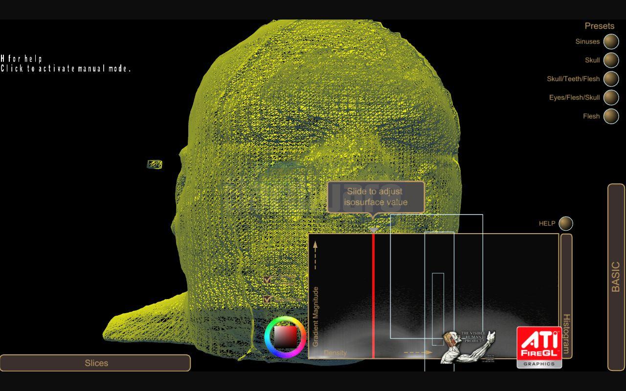 [29/10/2008] Medical Visualization: Ati FireGL V8600