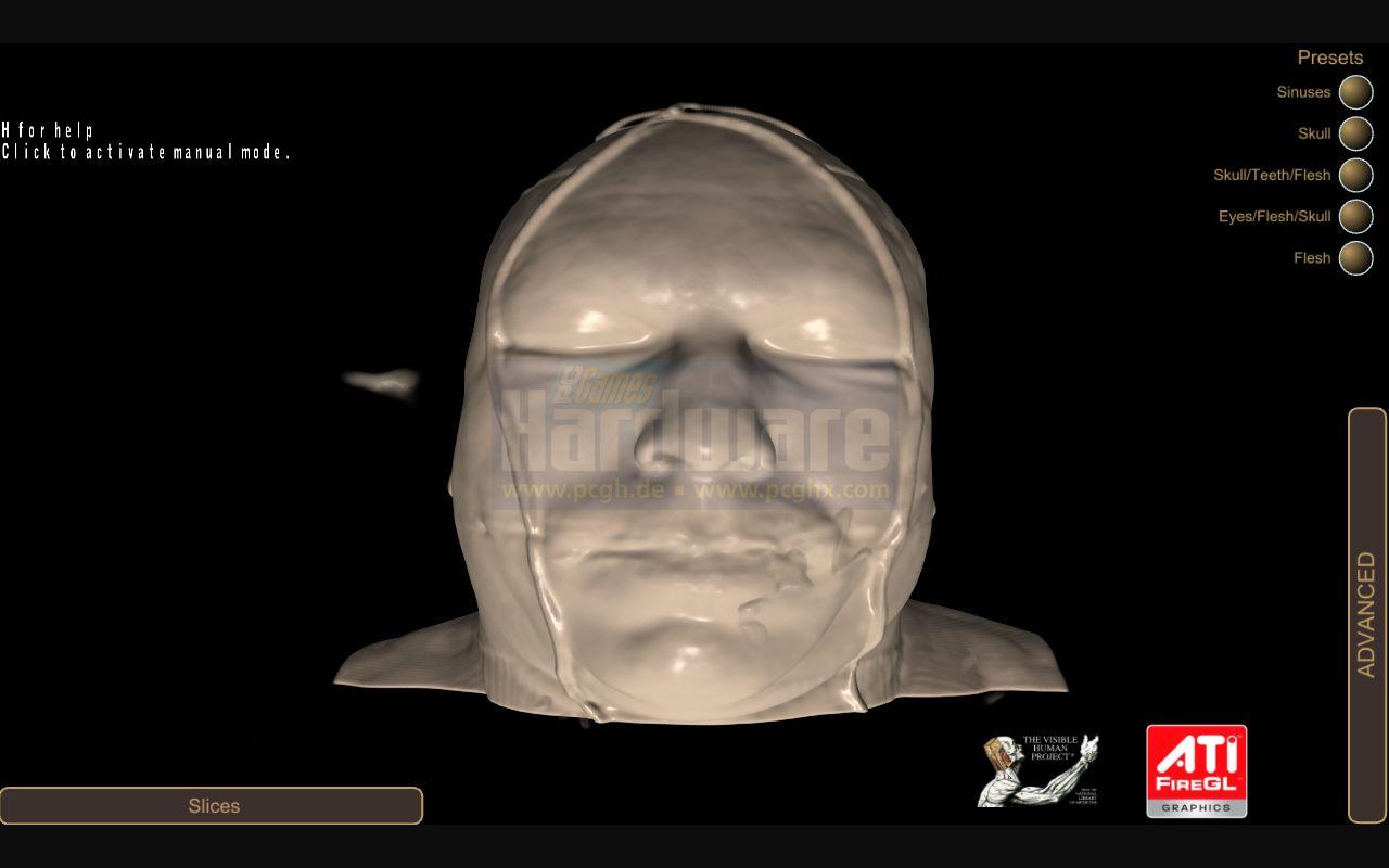 [29/10/2008] Medical Visualization: Ati FireGL V8600
