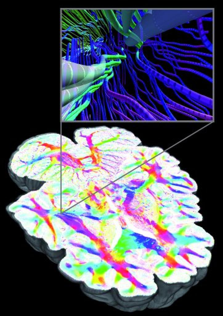 [19/06/2012] Neurowissenschaft: Nvidia-Tesla-GPUs helfen beim Entschlüsseln des menschlichen Gehirns