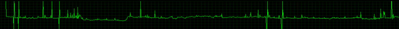 [11/02/2015] Evolve Frametimes - GTX 970/4G, 3.840 × 2.160, SMAA 1TX