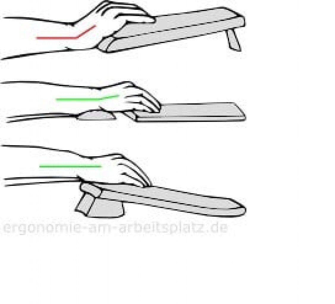 [12/12/2025] Spannungen im Handgelenk bei unterschiedlichen Tastaturen mit und ohne Handballenauflage.