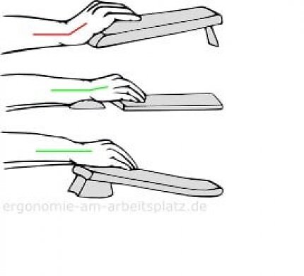 Spannungen im Handgelenk bei unterschiedlichen Tastaturen mit und ohne Handballenauflage.