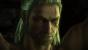 The Witcher 2 mit allen Details und "Über-Sampling": 20 Fps auf Nvidia GTX 580 OC, Core i7-860 und 4 GiByte DD3-1600 (1)