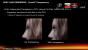 Project Phoenix: Details zur AMD-Techdemo mit Cryengine 3 und TressFX (39)