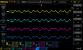 Sharkoon Silentstorm Cool Zero 650 Watt im Test - Ripple 12-Volt-Leitung