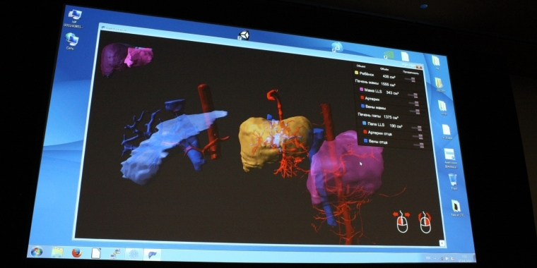 Chirurgen helfen drei Simulationsmethoden bei der OP-Vorbereitung.